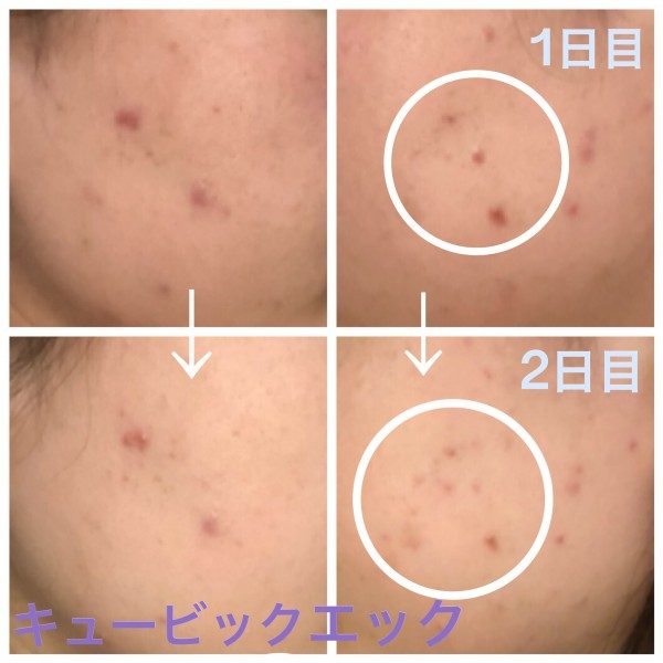 73341DC1-36F6-4C01-815E-0CF39E8536DE